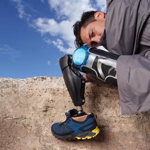 Woman with prosthetic leg is sitting