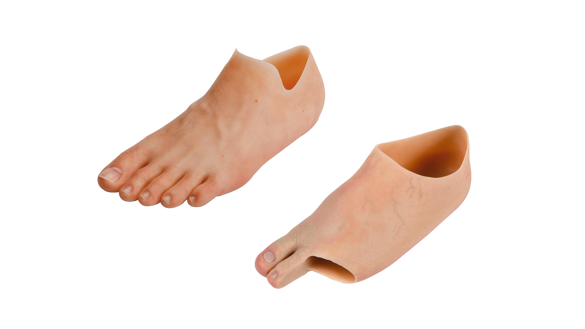 FirstSpiritExport,OBISCM-1557,web_site,prosthetics_2,prosthetics_life_with_forefoot_amputation,prosthetics_life_with_forefoot_amputation_images