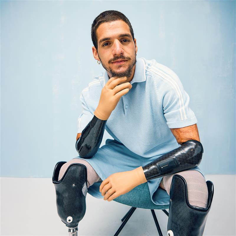 Ottobock user Davide with his MyoHand VariPlus Speed prosthetic hands.