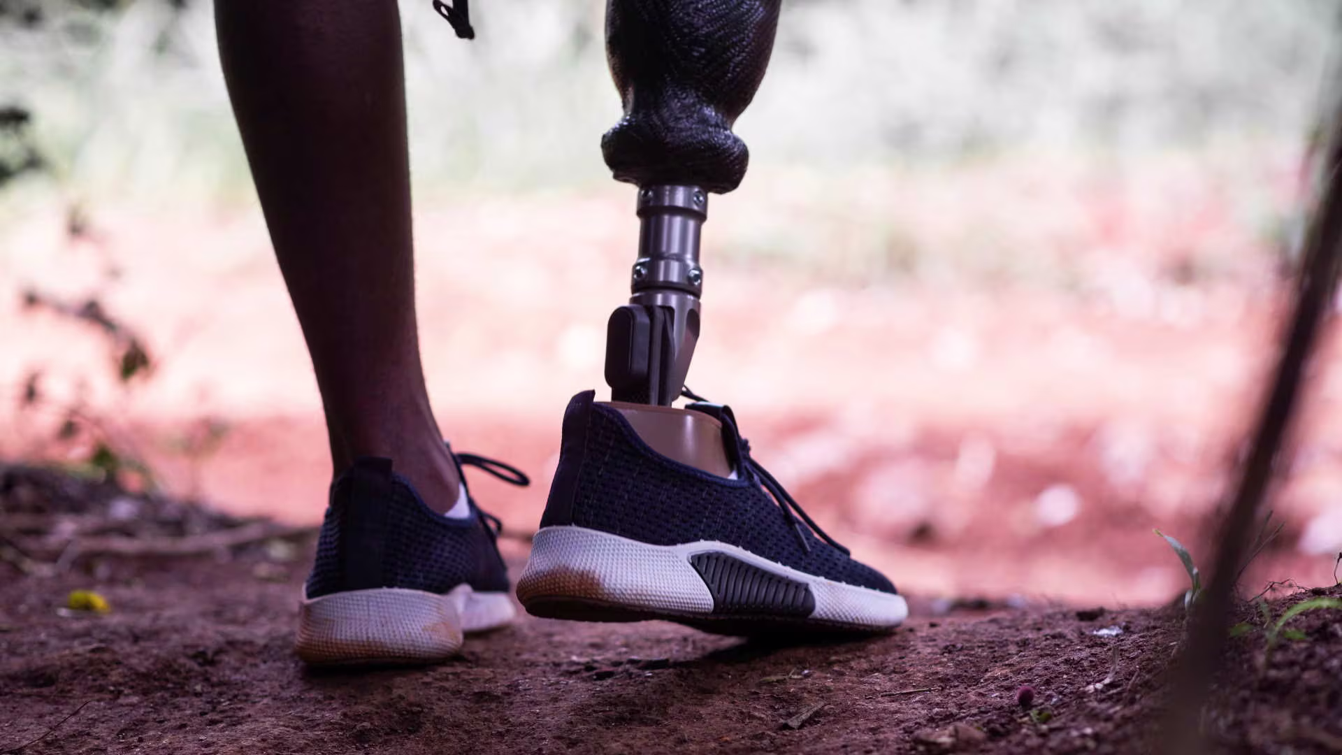 Kenya prosthetic feet Jack