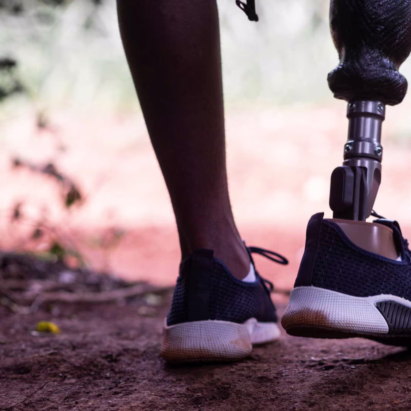 Kenya prosthetic feet Jack