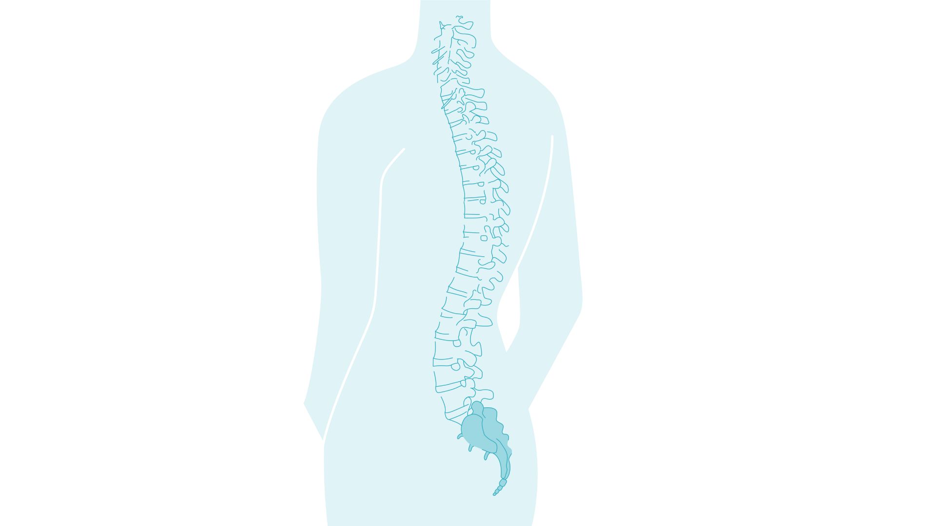 Sacral spine (lower back and buttocks) marked.