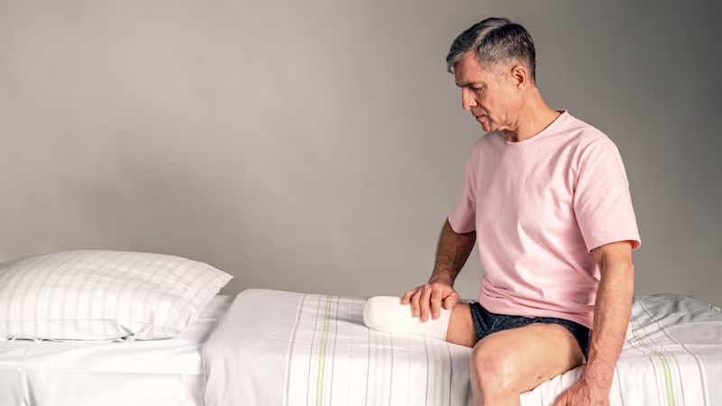 Amputee sitting on the bed looking at his residual limb