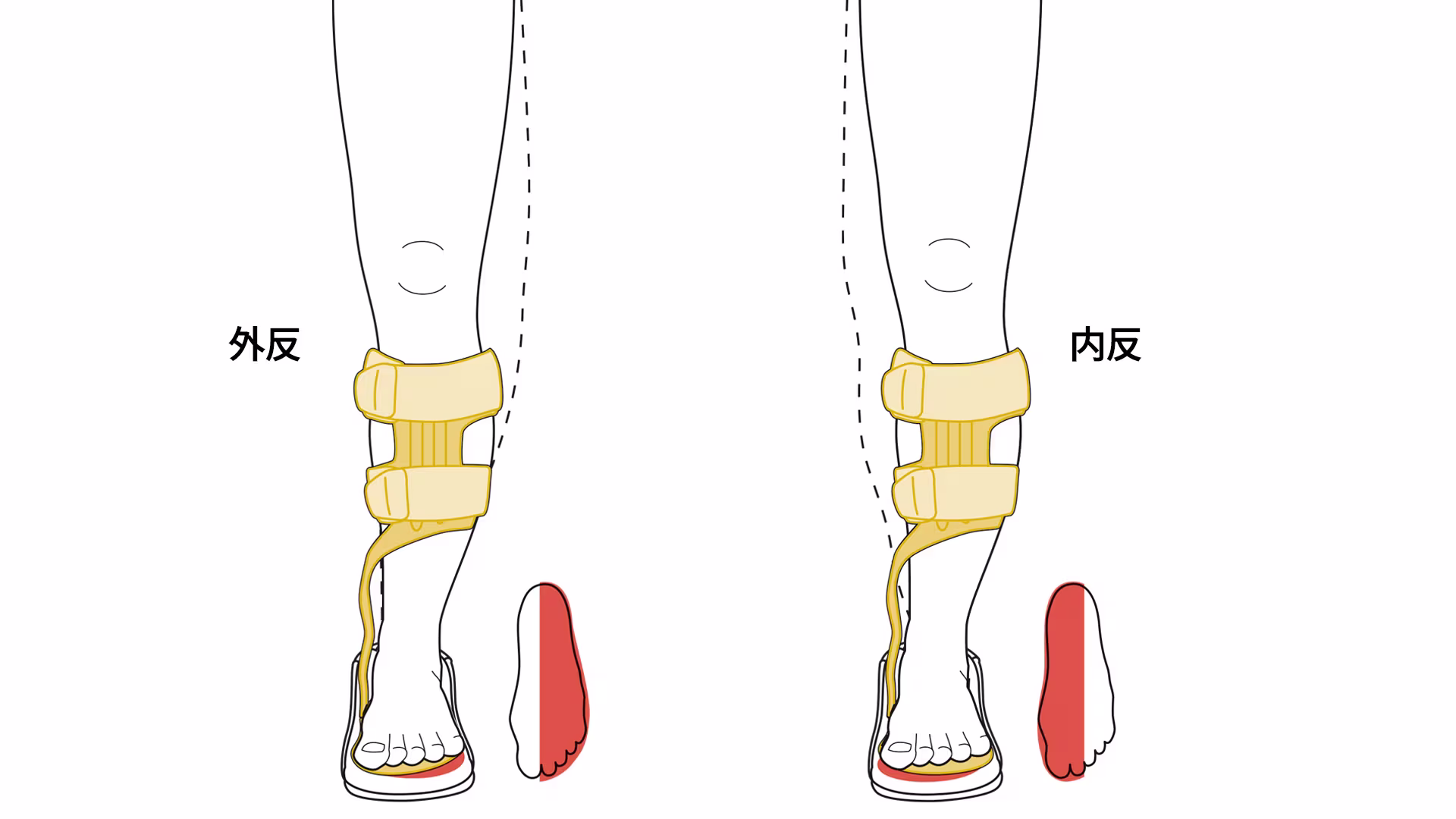 ウォークオン ウェッジの活用