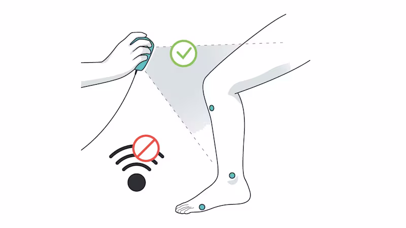 FirstSpiritExport,OBISCM-1557,web_site,prosthetics_2,ifab_1,ifab_images