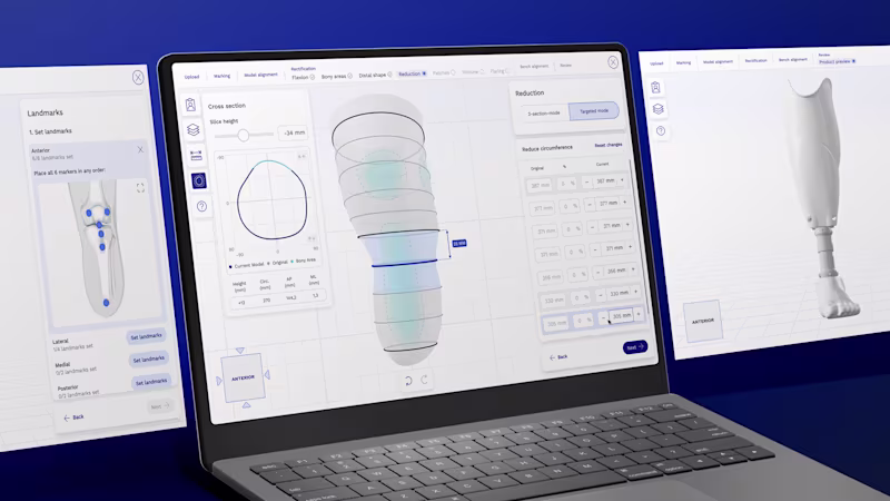 Laptop displaying CADkit software during the transtibial socket design process.