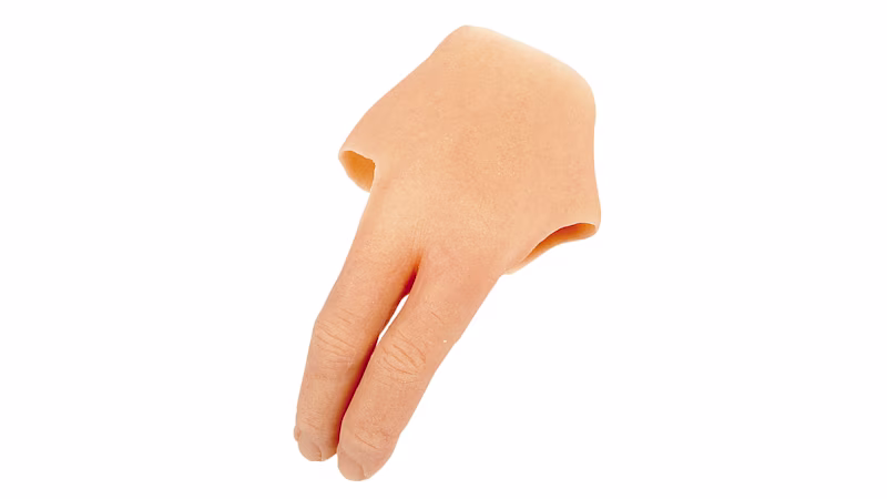 FirstSpiritExport,OBISCM-1557,web_site,prosthetics_2,living_with_finger_amputation