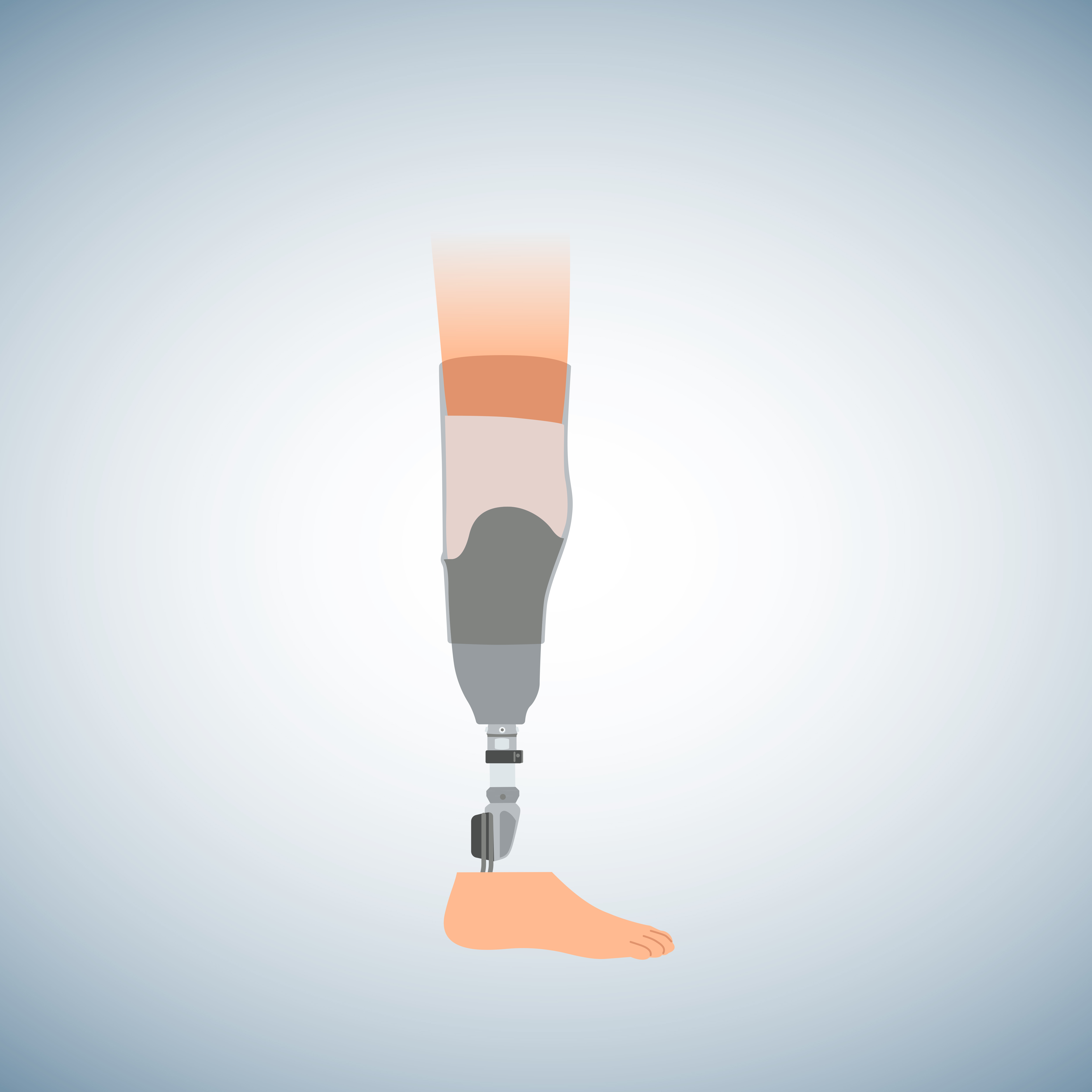 Schematic illustration of a below-knee prosthesis.