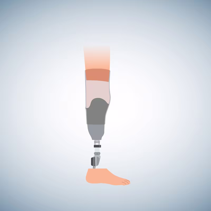 Schematic illustration of a below-knee prosthesis.