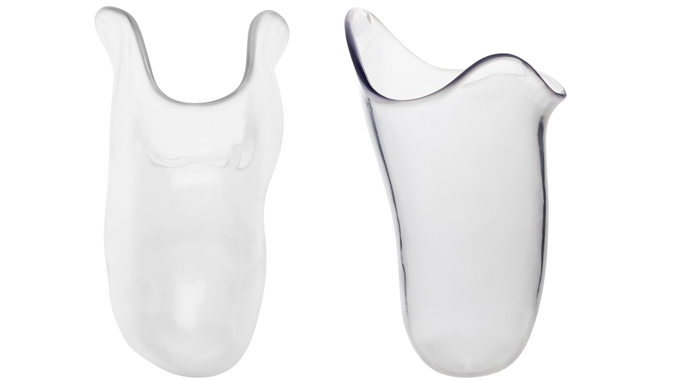 Una cavidad residual del muñón