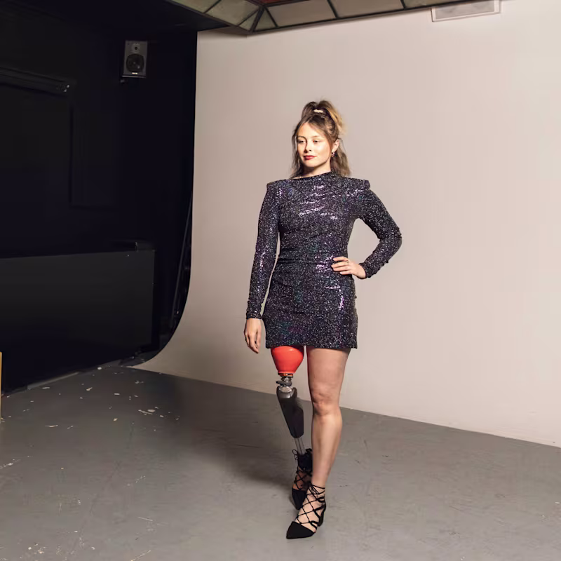 C-Leg user Sarah wearing a black dress posing on a modelling shoot.