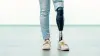 Un utilisateur de prothèse avec Genium X3 se tient debout