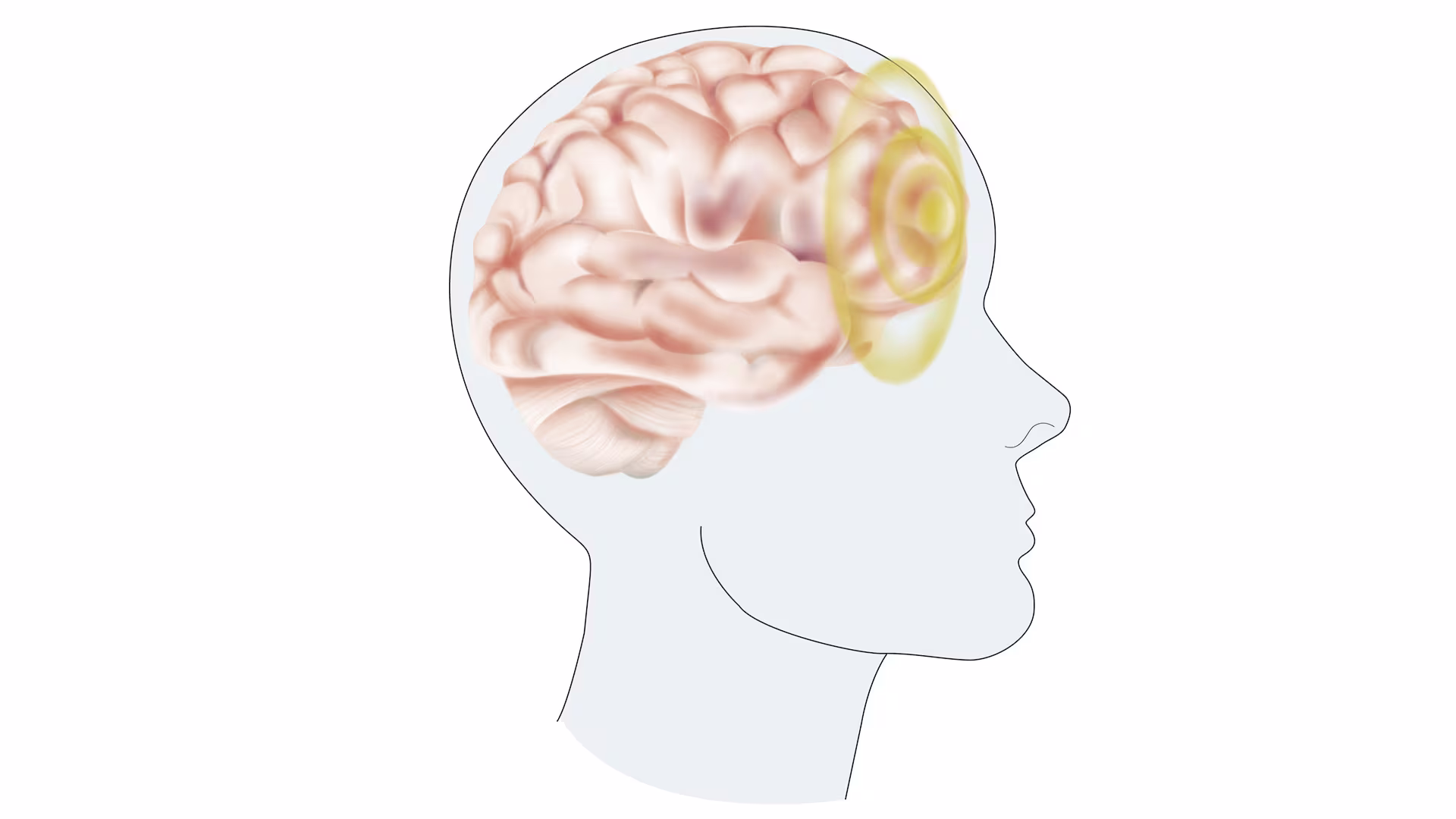 -35272 SHT--169-col(1443106) en