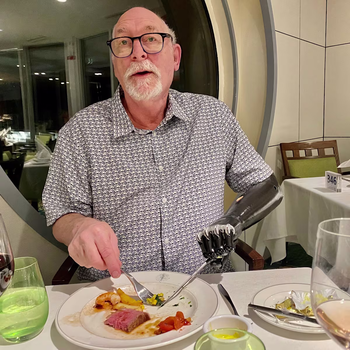 Mike bebionic Prosthetic Arm