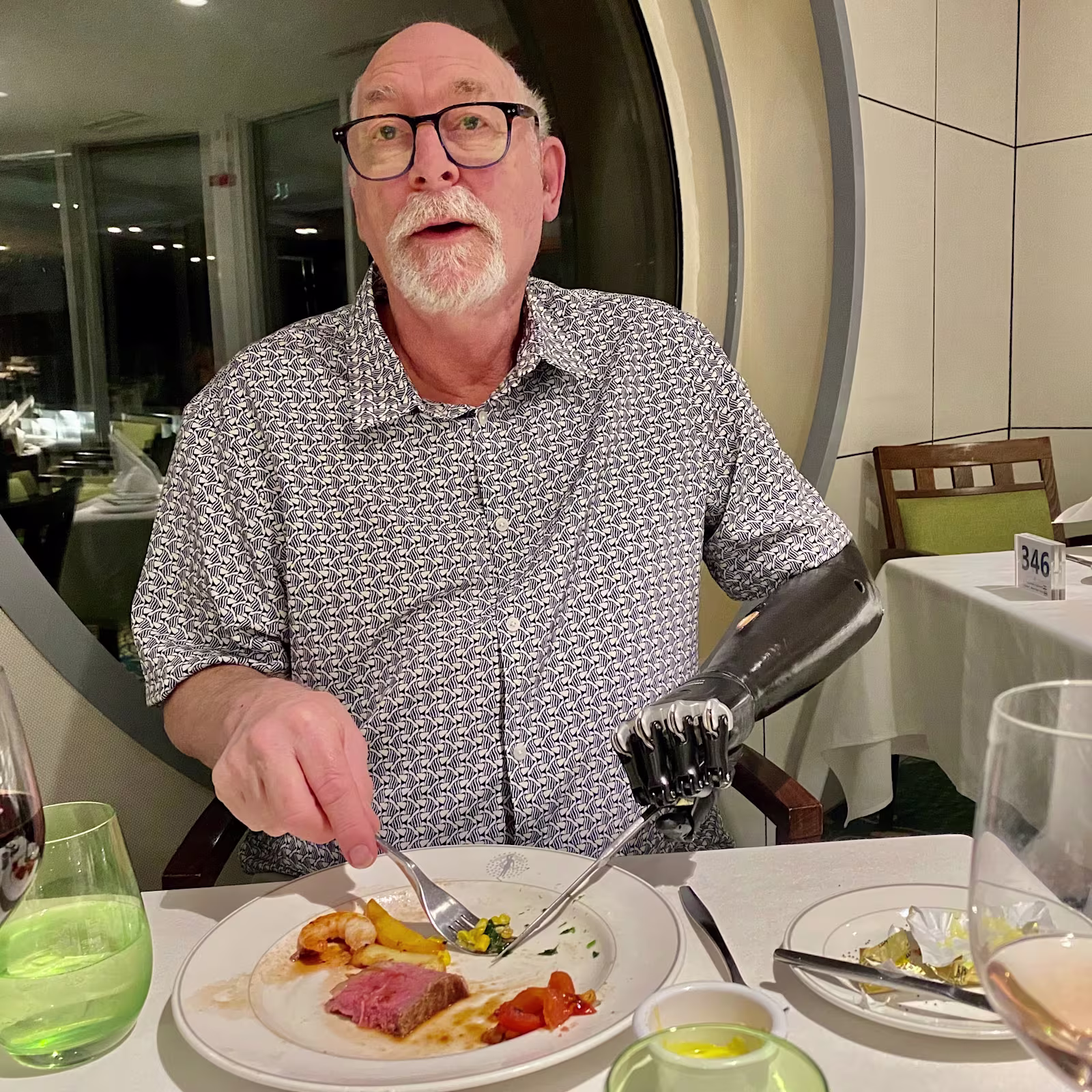 Mike bebionic Prosthetic Arm