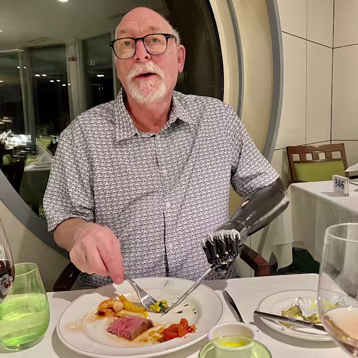 Mike bebionic Prosthetic Arm