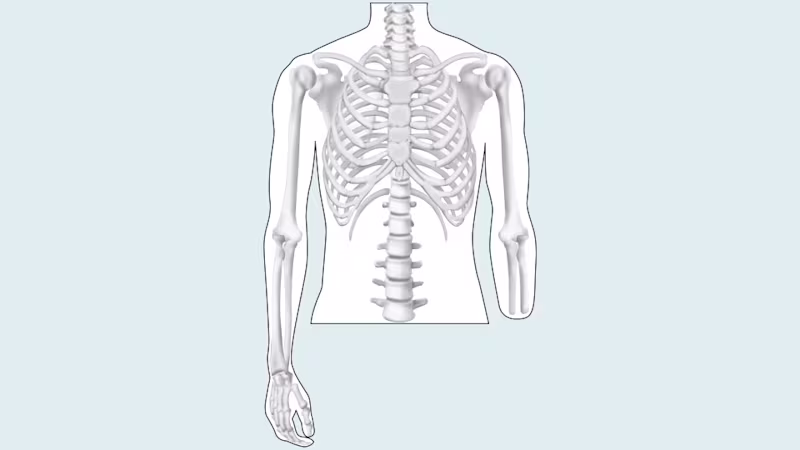 amputation level upper limb drawing 16 9 content-6