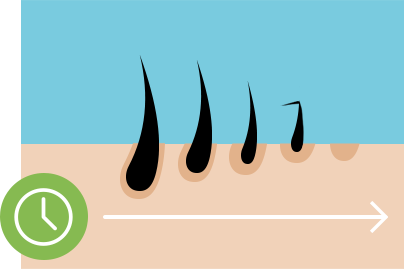 hair follicle decrease