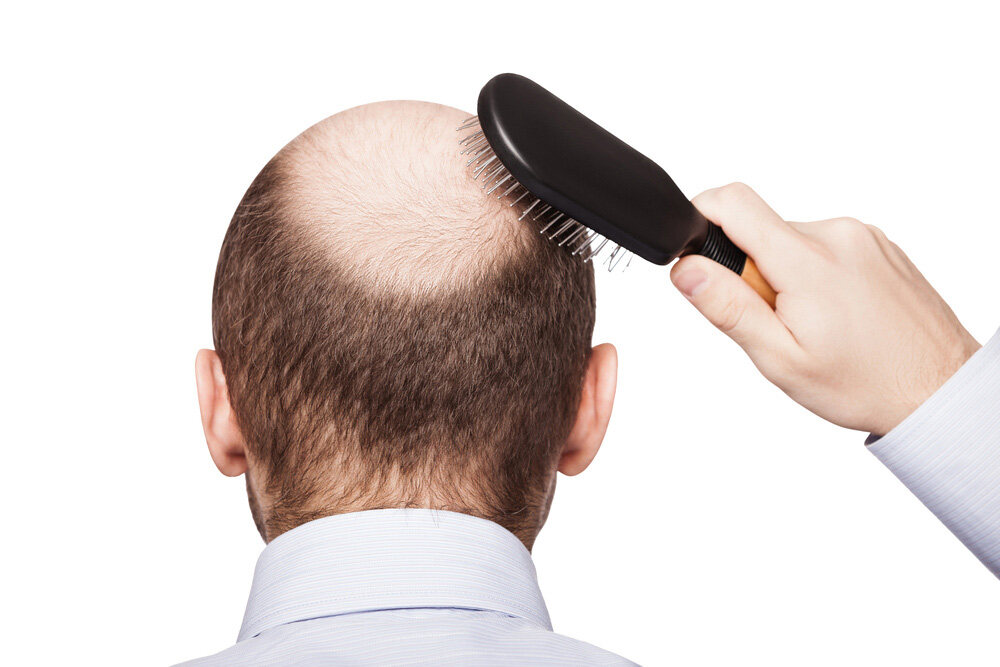 balding man with a hairbrush