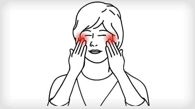 Location of maxillary sinus highlighted behind a woman's cheekbones