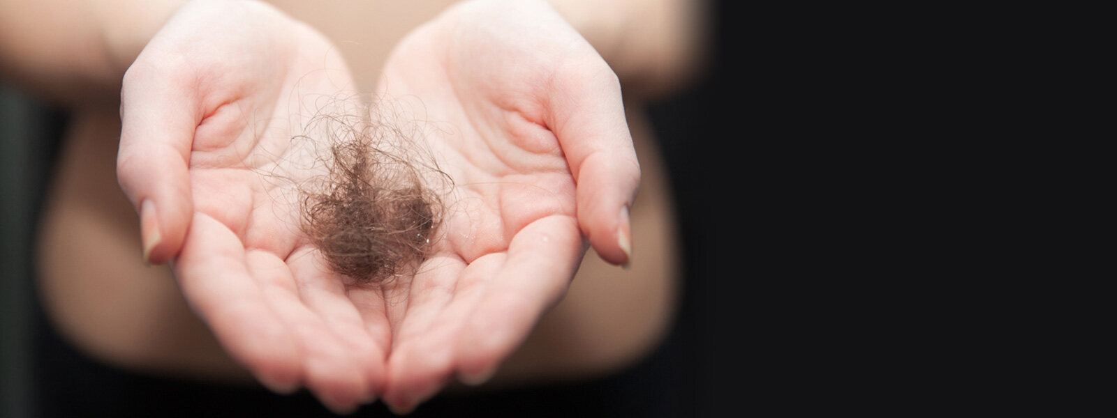 womans hands holding a chunk of lost hair