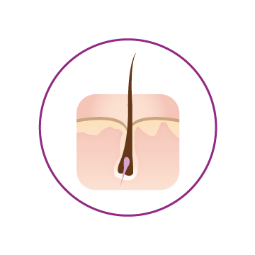 ROGAINE® hair follicle growth