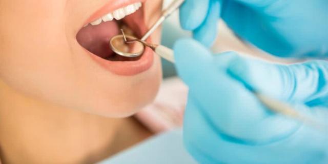 Curetage dentaire : fonctionnement et remboursement