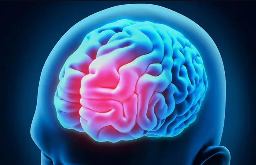 Brain Scan