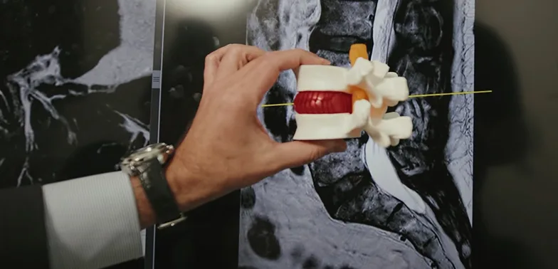 Compression of the Spine