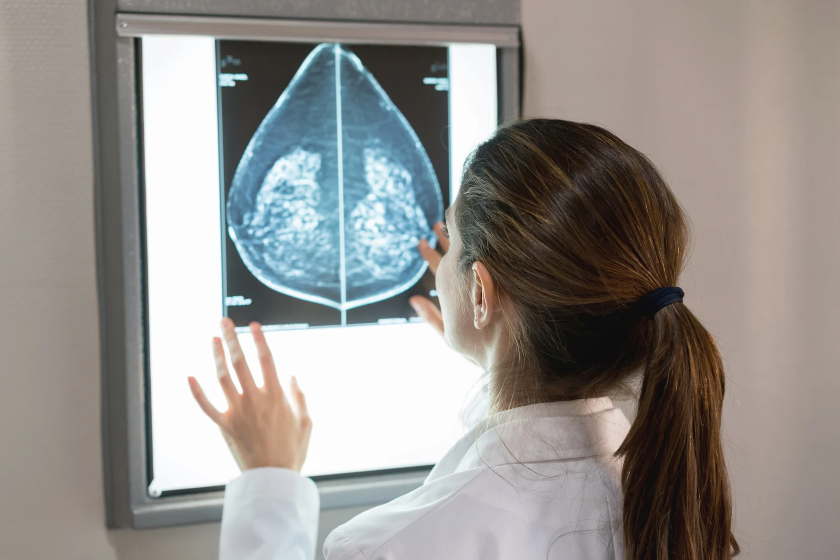 Abbreviated Breast MRI