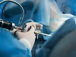 Endoscopic Spinal Surgery