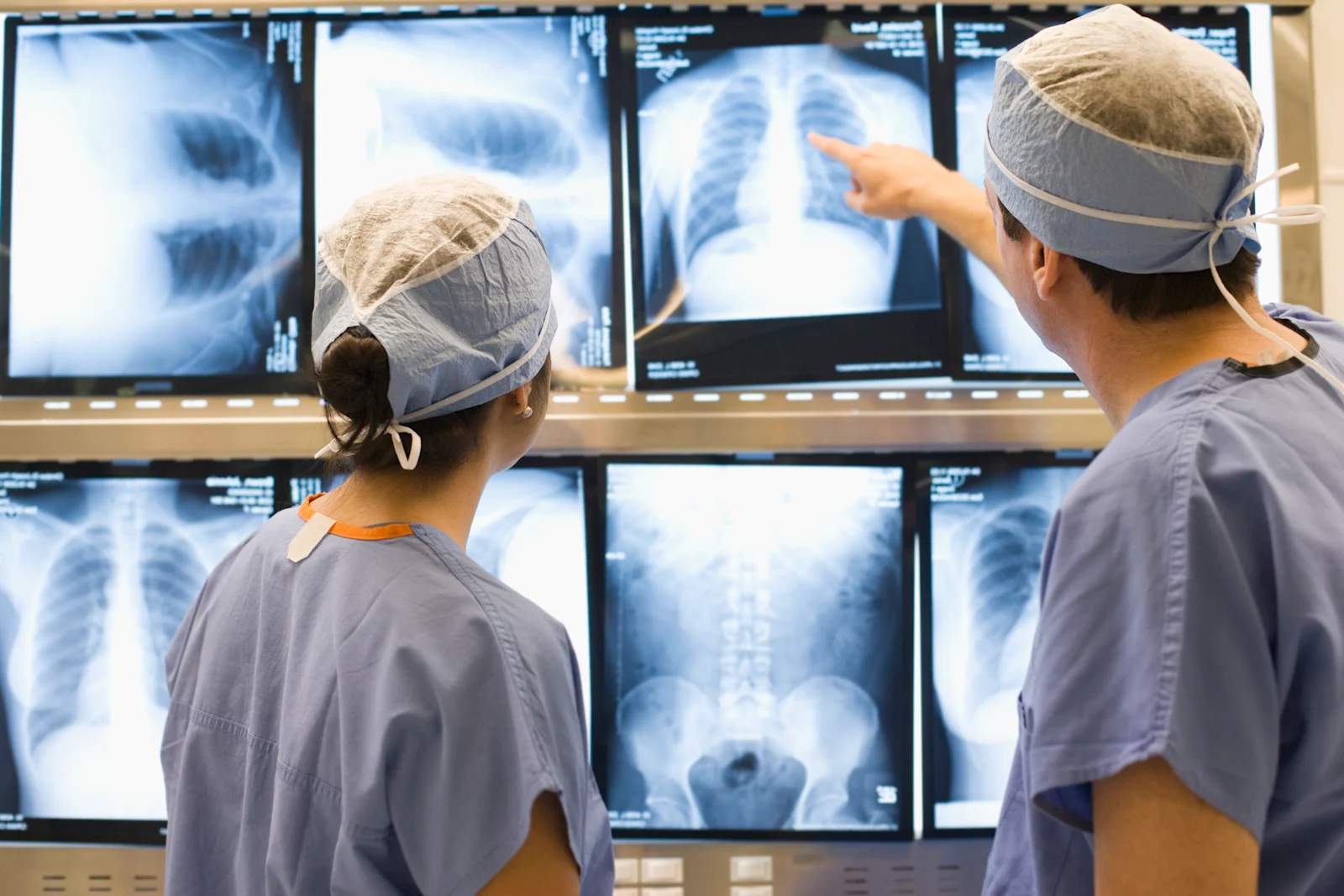 Doctors looking at lung x-rays