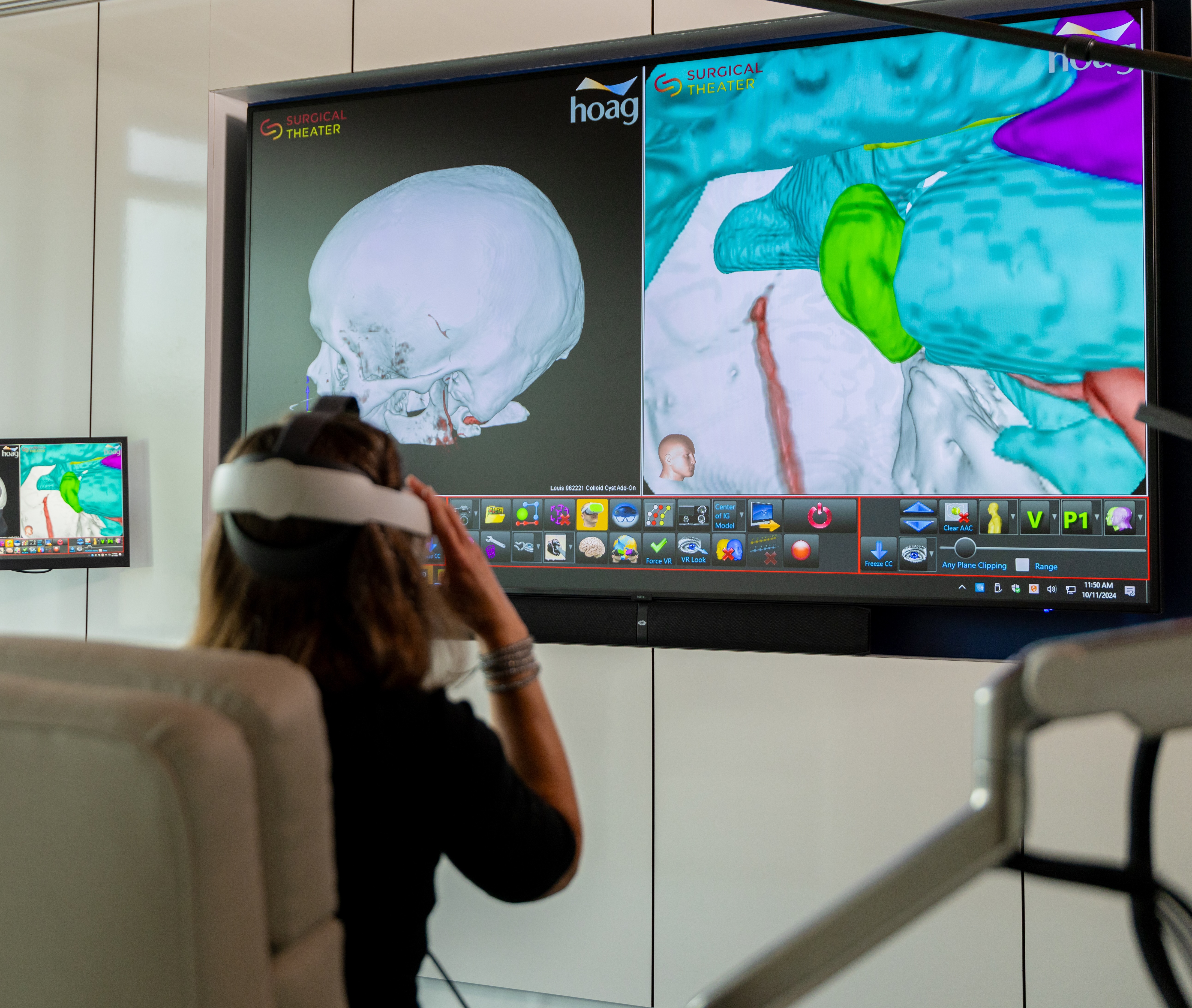 Inside Surgical Theather