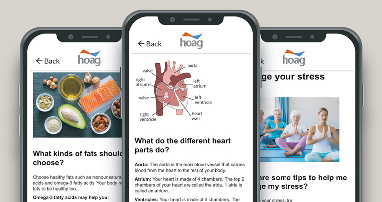 Three phones that are running Hoag's new app