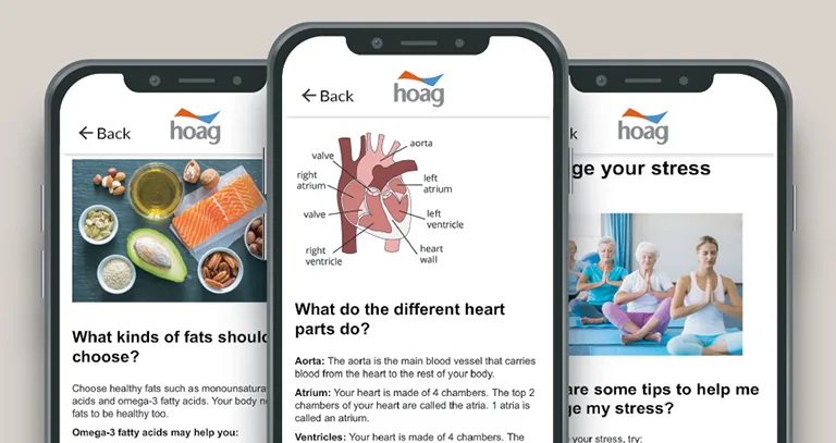 Three phones that are running Hoag's new app