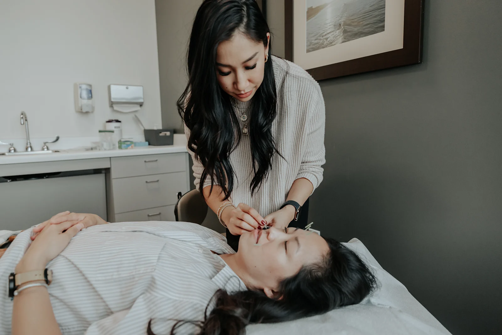 Acupuncture
