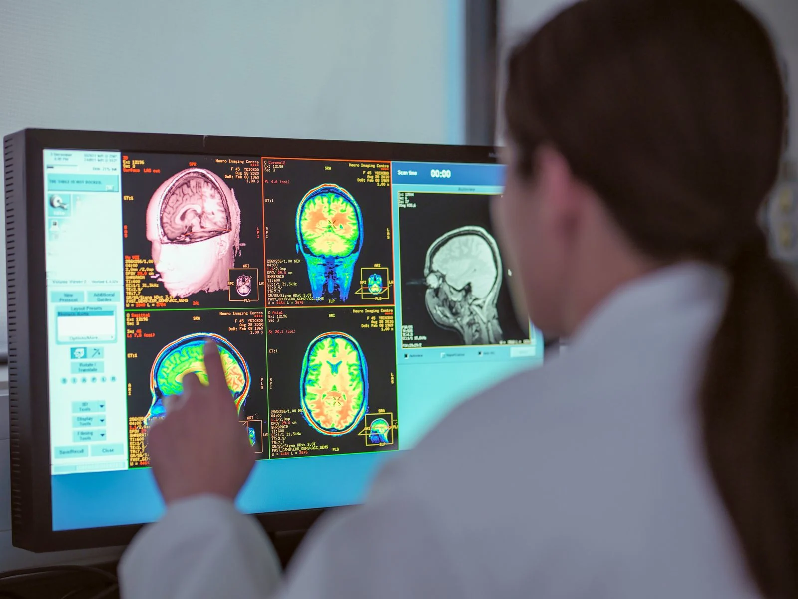 Brain scans