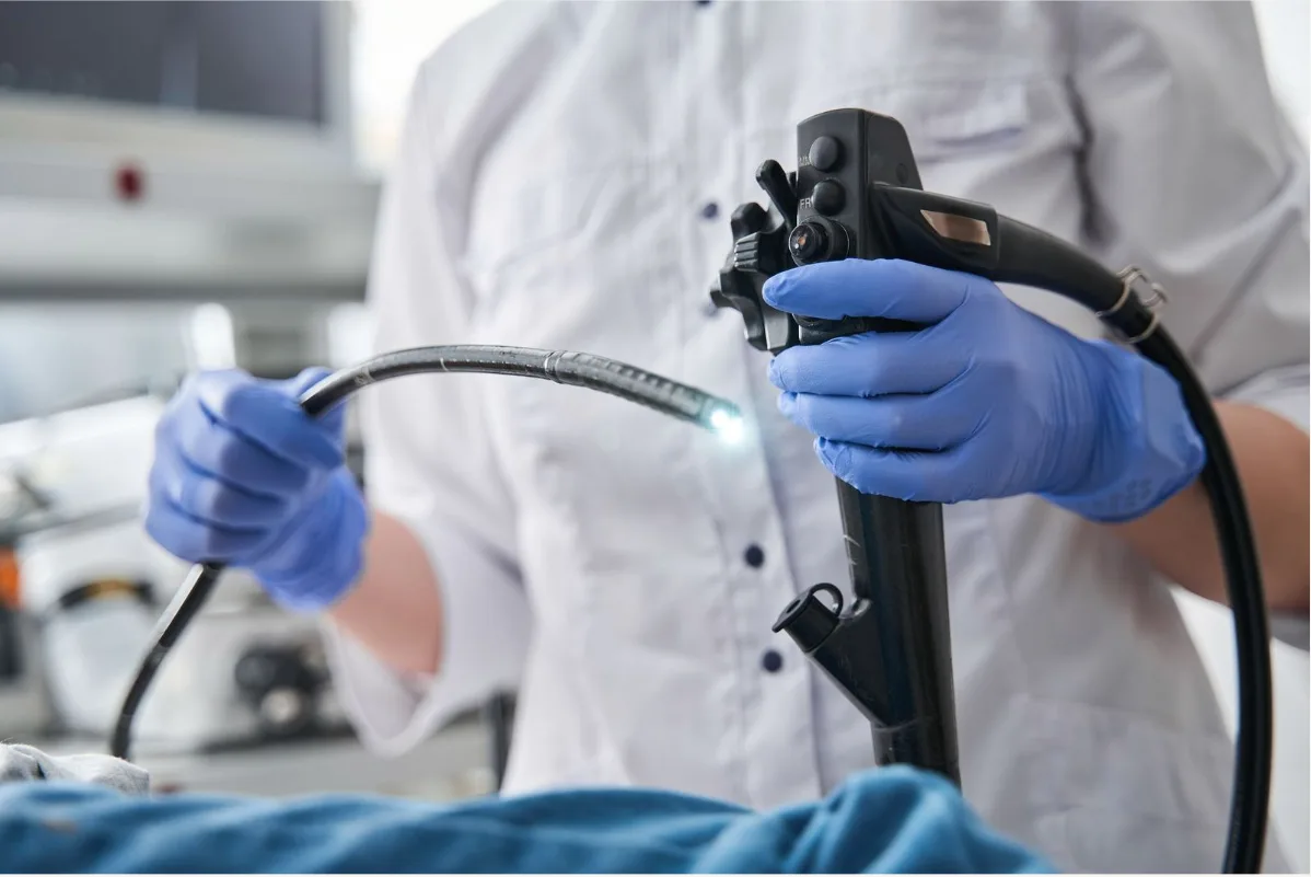 Endoscopy Procedure
