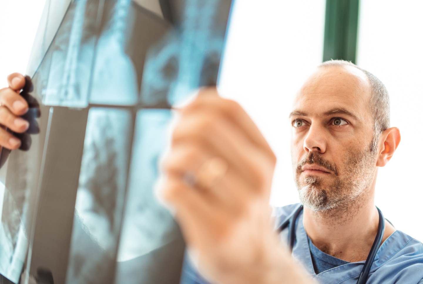 Man Inspecting X-Rays