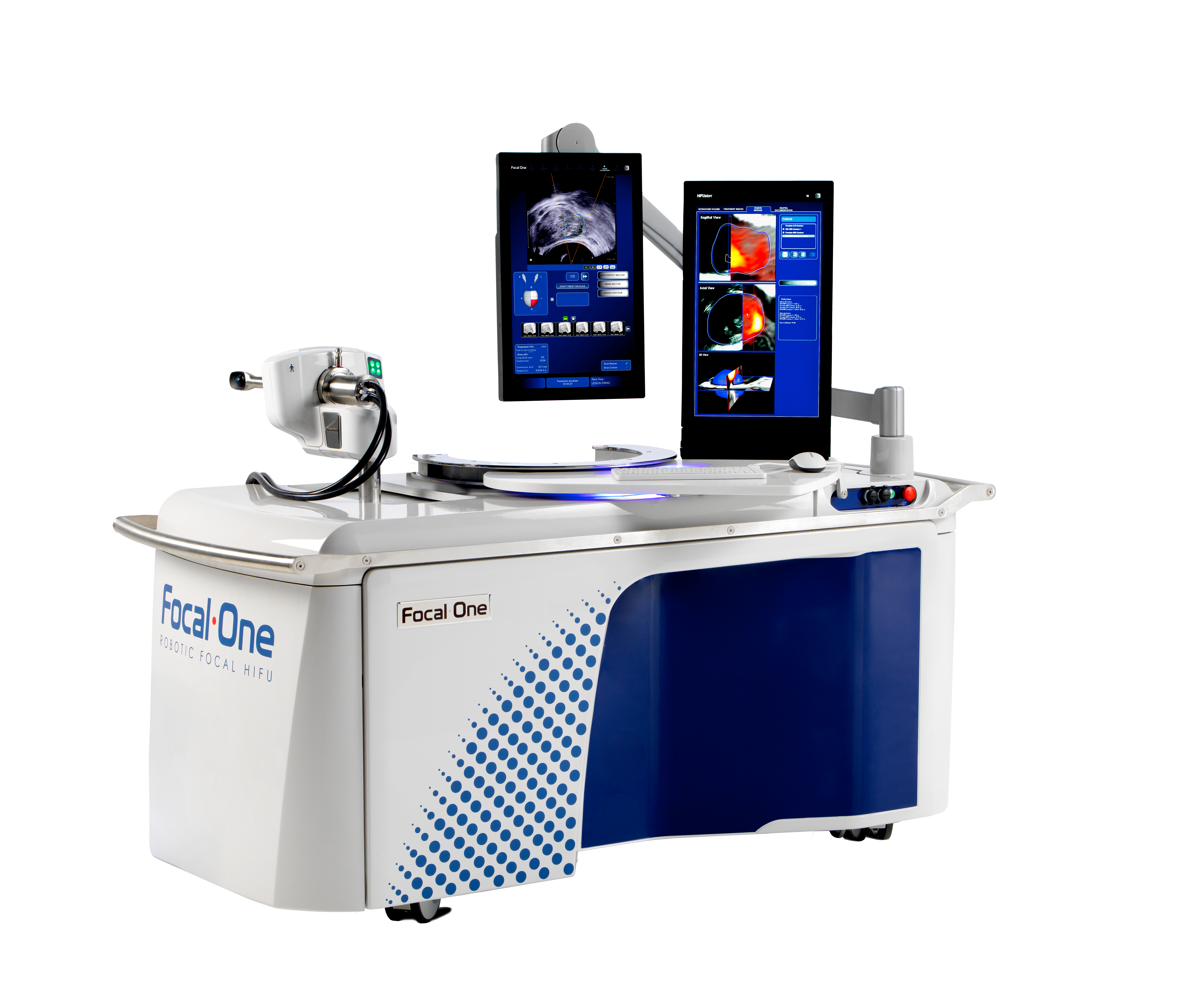 Focal One HIFU