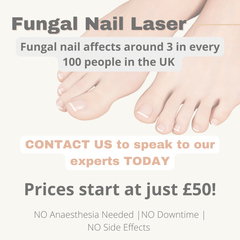 Laser Collective Liverpool Fungal Nail Laser Treatment Formby