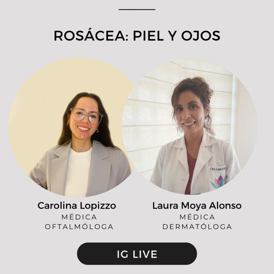Rosácea: piel y ojos
