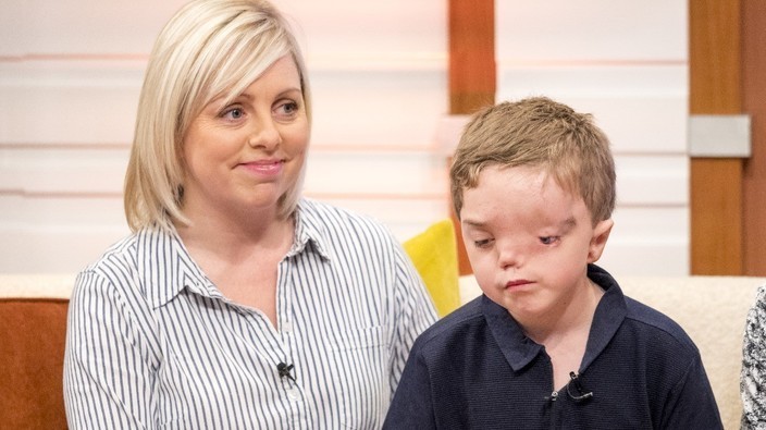 Mum's fury after Instagram picture of her son's face is removed | Good ...