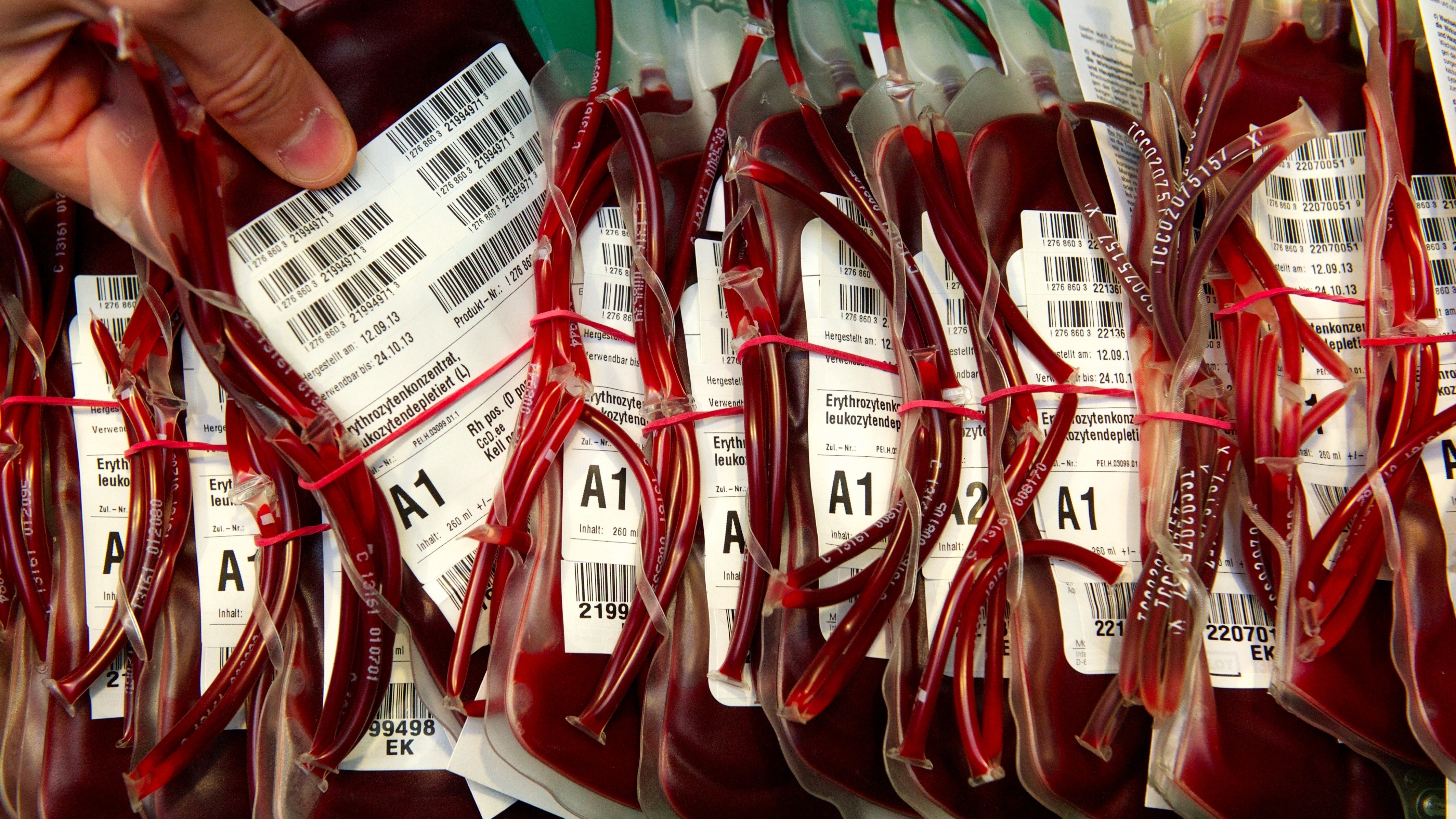 3 литра крови. Пакет с кровью для переливания.