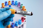 doctor with Blood tube test for Complete Blood Count