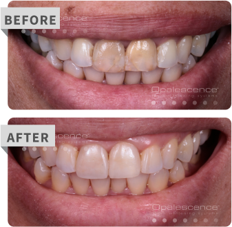 specialty before after