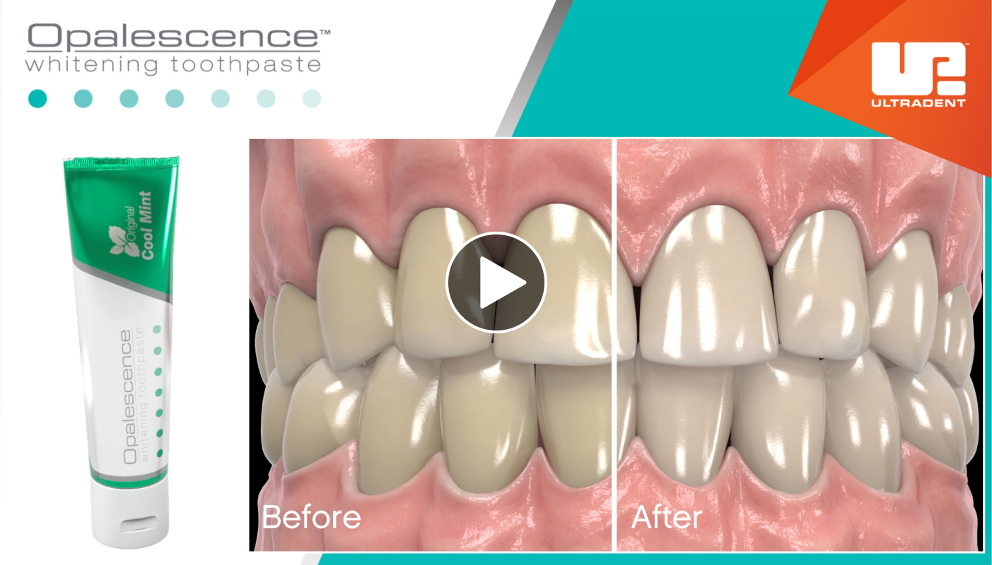 See why it's the leader in teeth whitening toothpaste