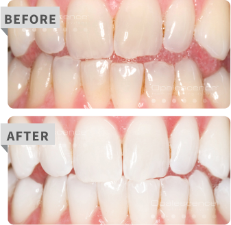 pf before after
