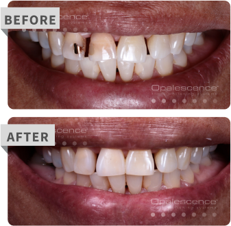 specialty before after
