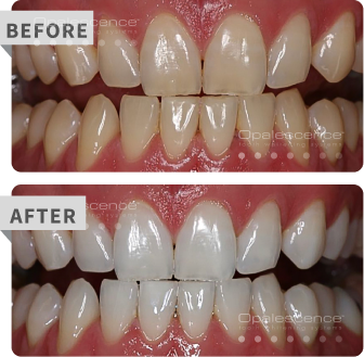 boost before after